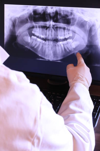 Best Emergency Dentist for Knocked-Out Tooth in Stratford, OK