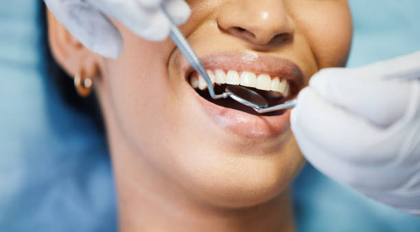 Best Emergency Root Canal Treatment in Stratford, OK