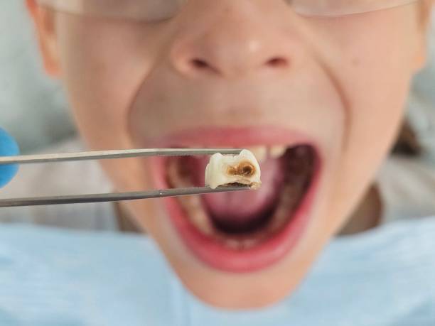 Best Pediatric Emergency Dentist in Stratford, OK